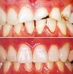 ESTÉTICA DENTAL